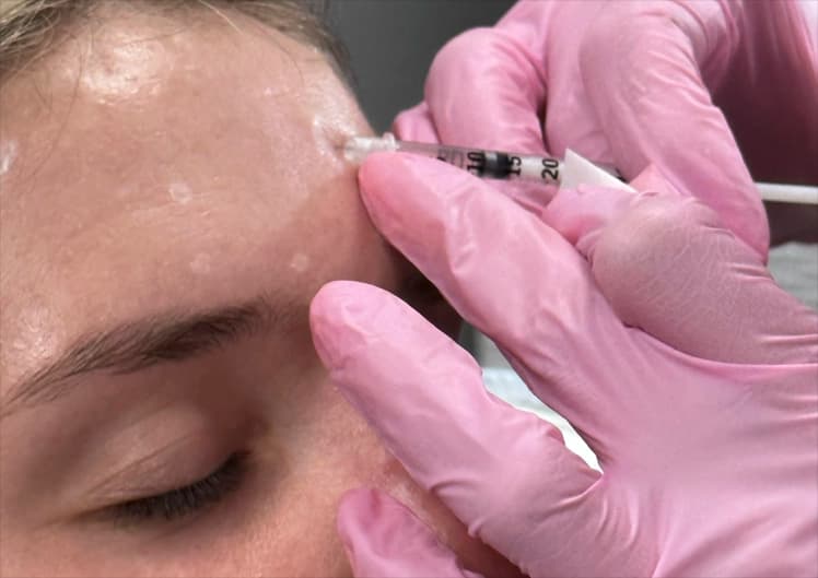 Botox & Wrinkle Reducers